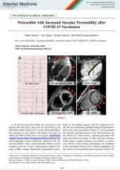 Pericarditis after covid vax picture