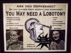 Once upon a time trust the science meant get a lobotomy for depression