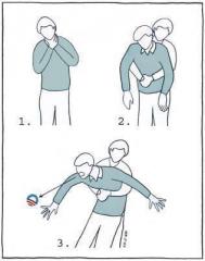 Emergency Instructions - What To Do If You Are Choking On Obama