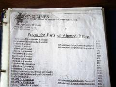 Prices for parts of aborted babies