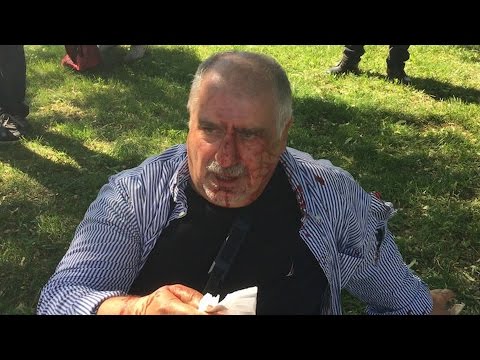 &quot;I Could Have Died&quot;: Protesters Detail Violent Attack by Turkish President Erdogan&#039;s Guards in D.C.
